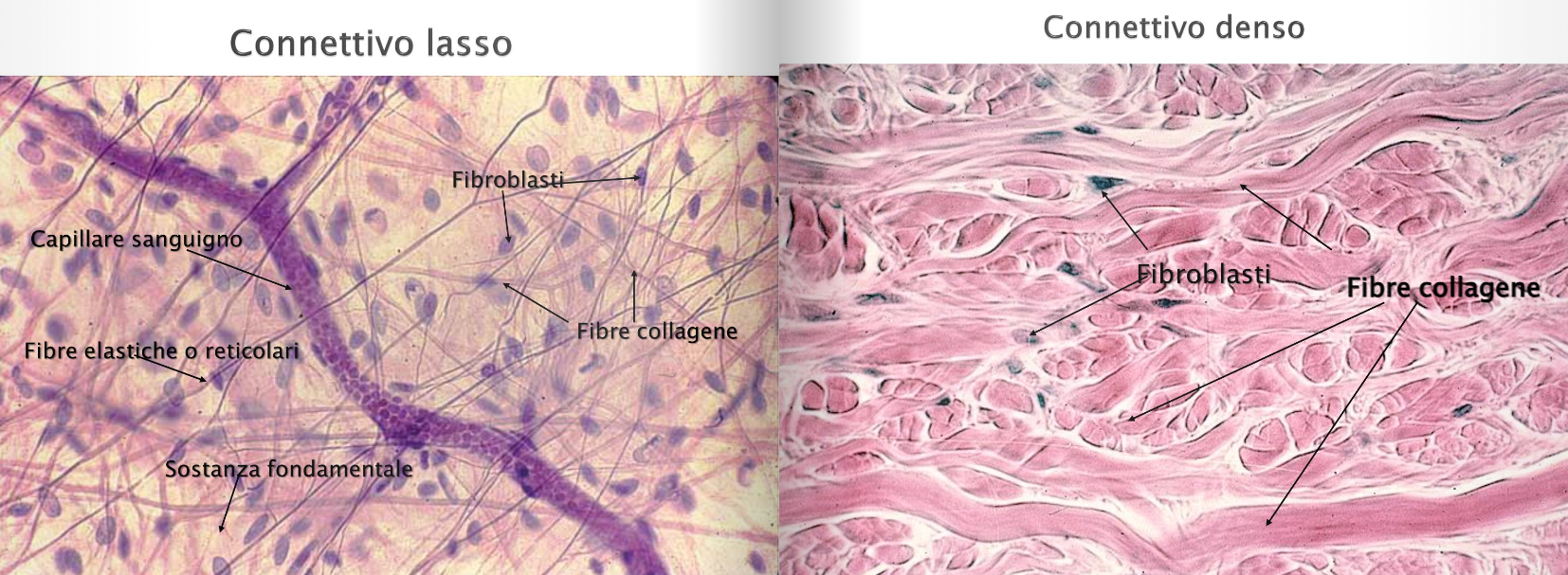 Connettivo lasso e denso Qui si vedono due de diversi tipi di tessuto connettivo, questi sono il connettivo lasso e il connettivo denso